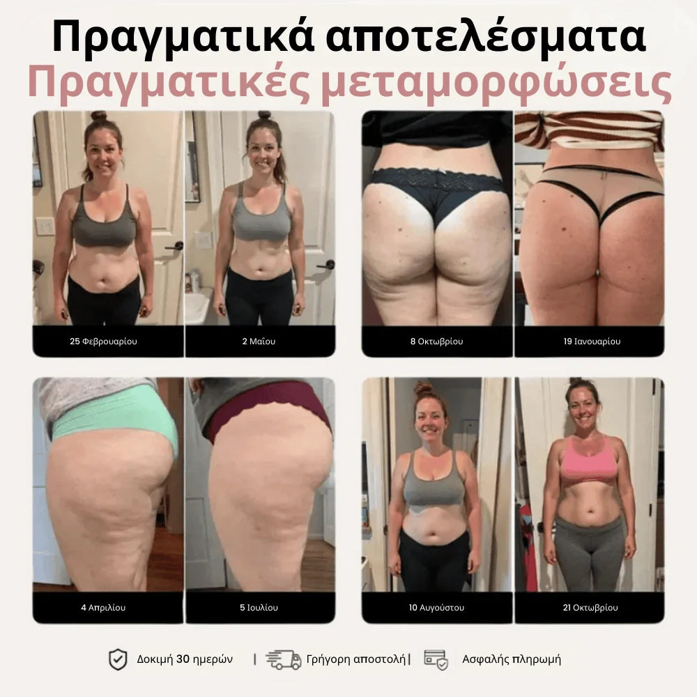 Navelle Metamórfi 3D – Επαναπροσδιορίστε τη σιλουέτα σας χωρίς κόπο πίσω